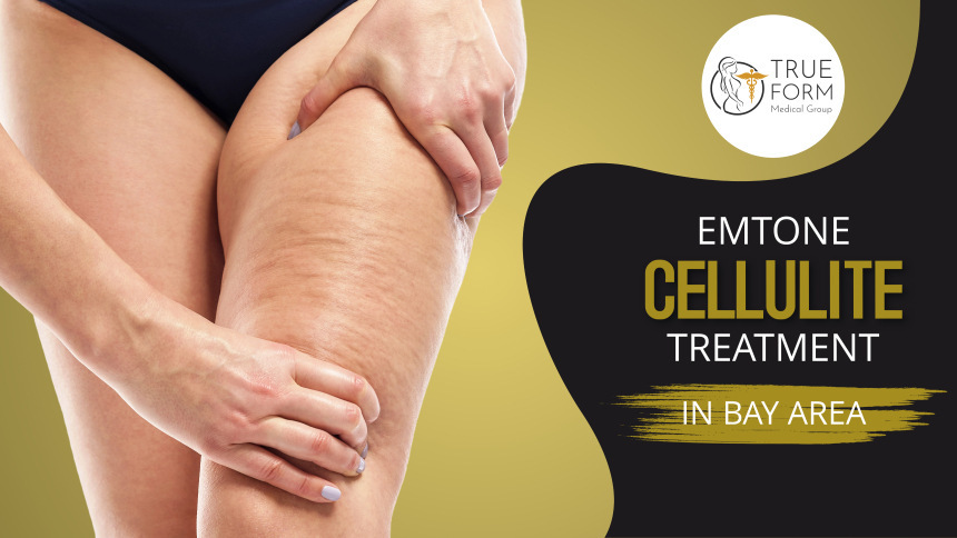 Emtone Cellulite Treatment in Fremont